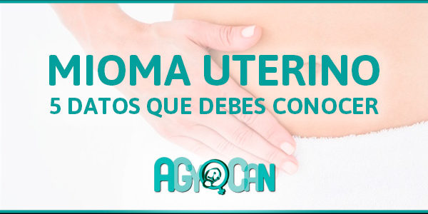 5 DATOS QUE DEBES CONOCER SOBRE EL MIOMA UTERINO 5 DATOS QUE DEBES CONOCER SOBRE EL MIOMA UTERINO
