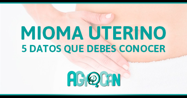 5 DATOS QUE DEBES CONOCER SOBRE EL MIOMA UTERINO 5 DATOS QUE DEBES CONOCER SOBRE EL MIOMA UTERINO
