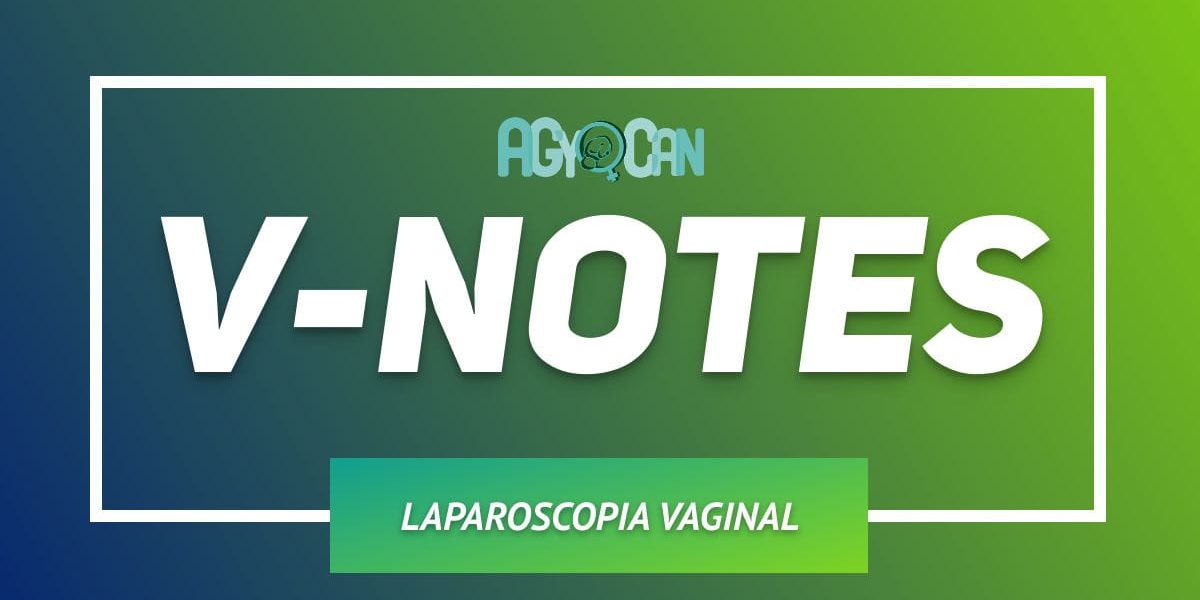 V NOTES v notes