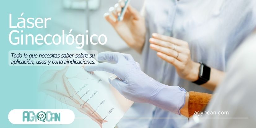Láser Ginecológico laser ginecológico